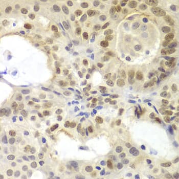 Polyclonal Rabbit anti-Human MSH6 Antibody (IHC, IF, WB)
