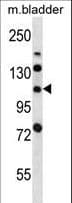 IHC-plus™ Polyclonal Rabbit anti-Human LRIG2 Antibody (aa817-845, IHC, WB)