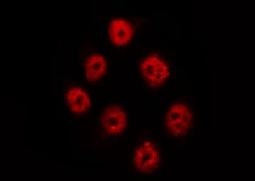 Polyclonal Rabbit anti-Human PTPN11 / SHP-2 / NS1 Antibody (phospho-Tyr542, IHC, IF, WB)