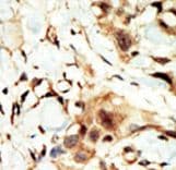 INSR / Insulin Receptor Antibody (aa21-52)