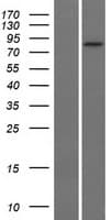 SLC26A4 / Pendrin Protein (Over-Expression Lysate Myc-DDK (Flag))