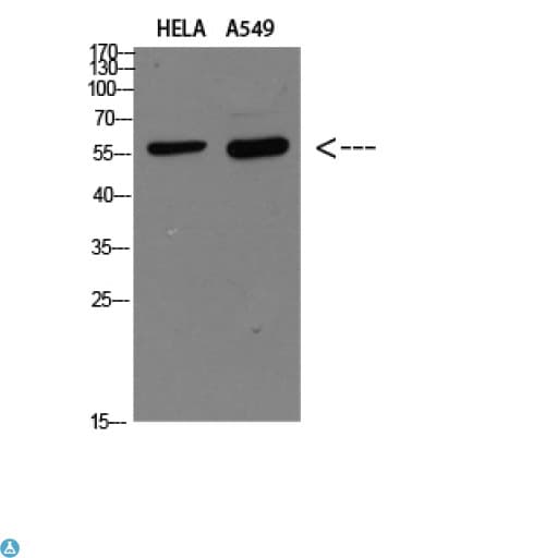DCT / Dopachrome Tautomerase Antibody
