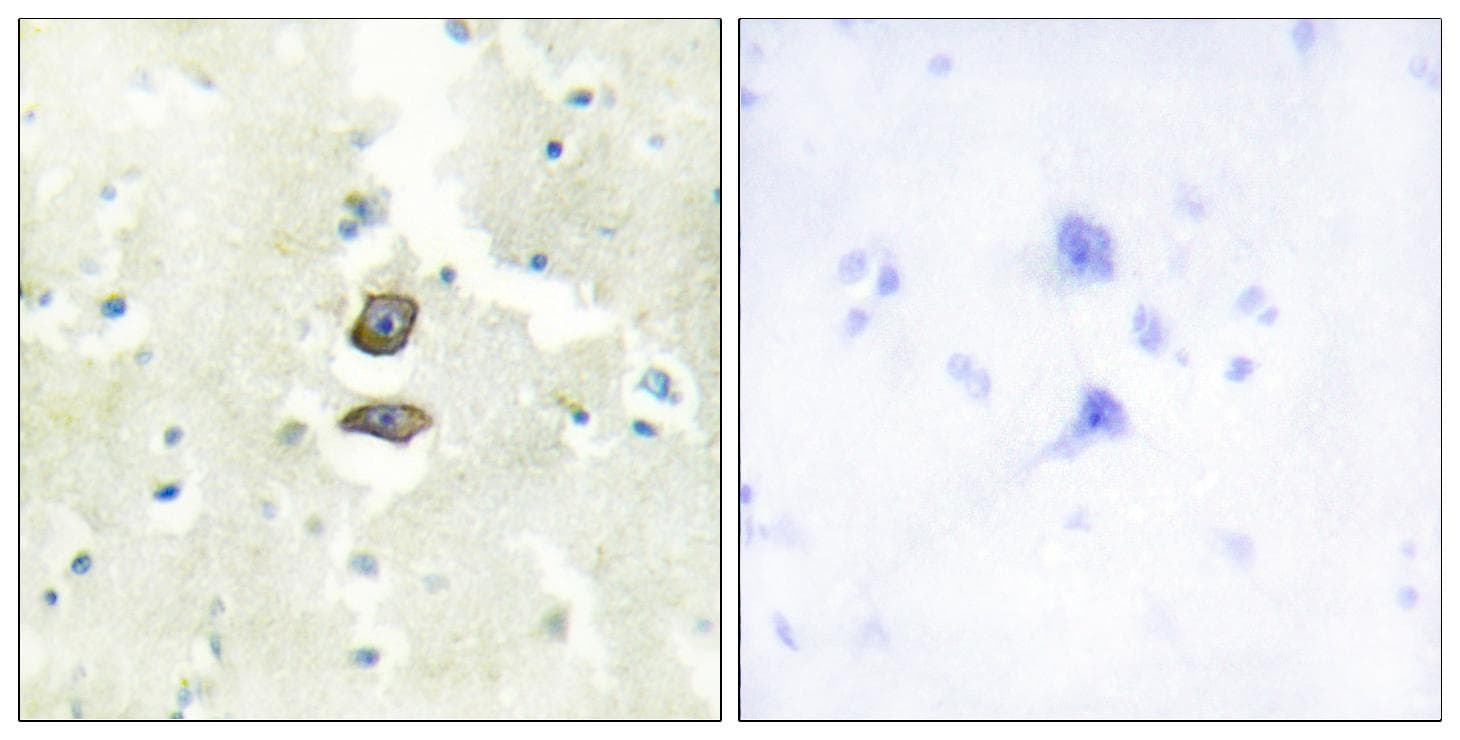 BRI3BP Antibody