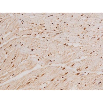 Polyclonal Rabbit anti-Human c-Kit / CD117 Antibody (IHC, IF, WB)