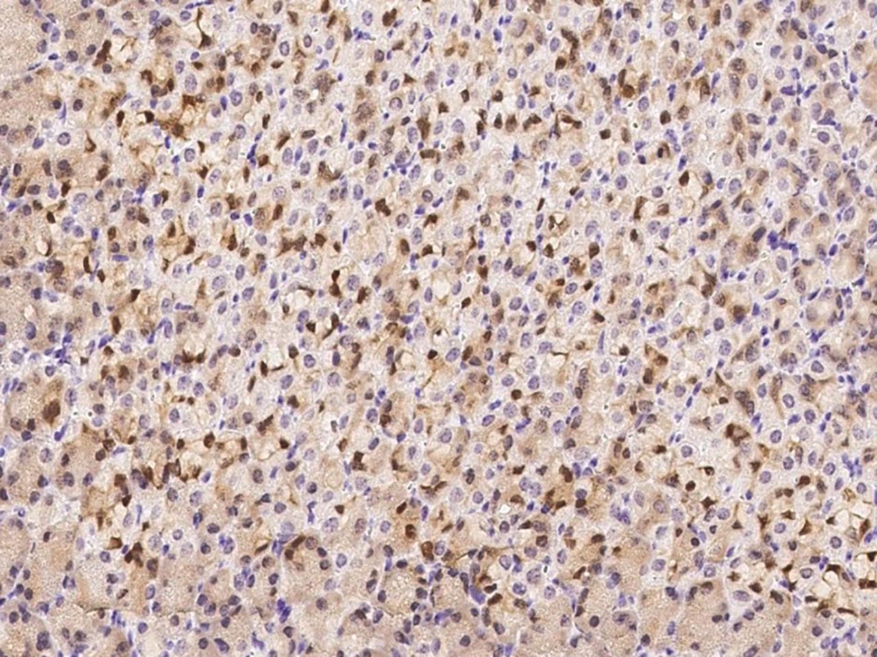 PPP3CA / CCN1 / Calcineurin A Antibody (Preservative Free)