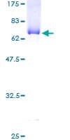 Human ABHD5 Protein (Recombinant GST)