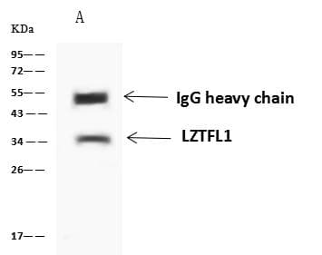 LZTFL1 Antibody