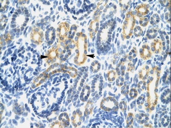 Polyclonal Rabbit anti-Human ICSBP / IRF8 Antibody (aa35-84, IHC, WB)