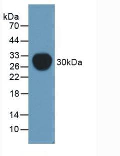 ABCB1 / MDR1 / P Glycoprotein Antibody (aa81-321)