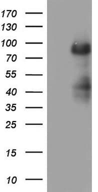 MDM2 Antibody (aa119-438, clone OTI6H3)