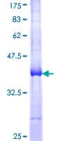 Human Pyrin / MEFV / MEF Protein (Recombinant GST, N-terminus)