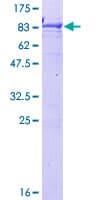 Human RCBTB2 Protein (Recombinant GST)