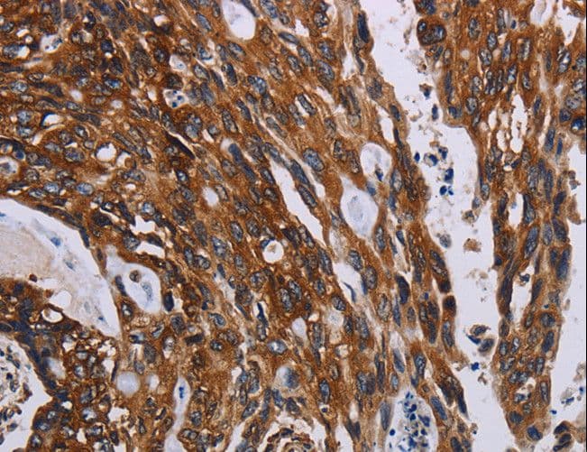 Polyclonal Rabbit anti-Human KARS Antibody (IHC, WB)