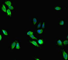 MEN1 / Menin Antibody