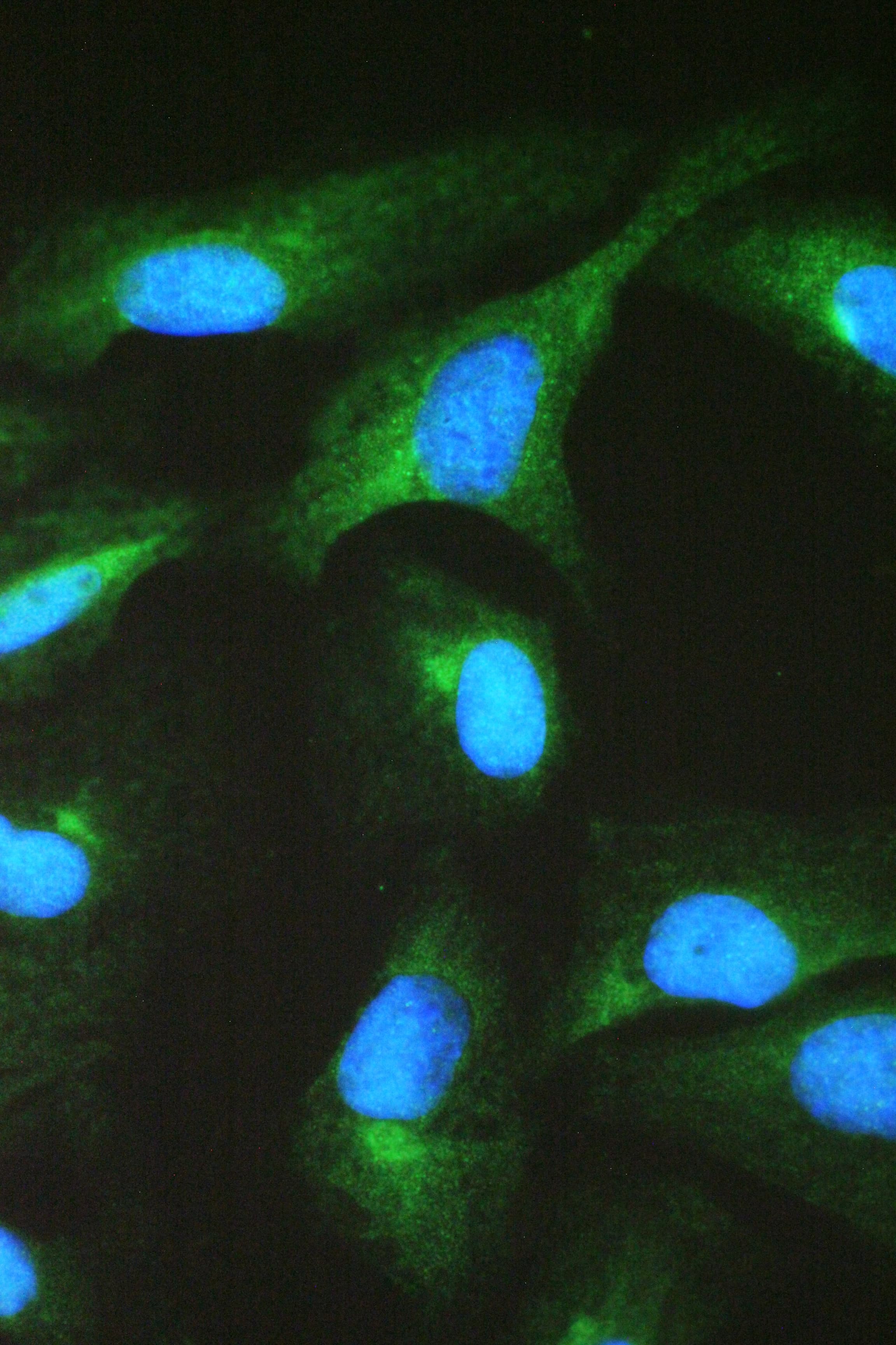 CCT2 / CCT Beta Antibody