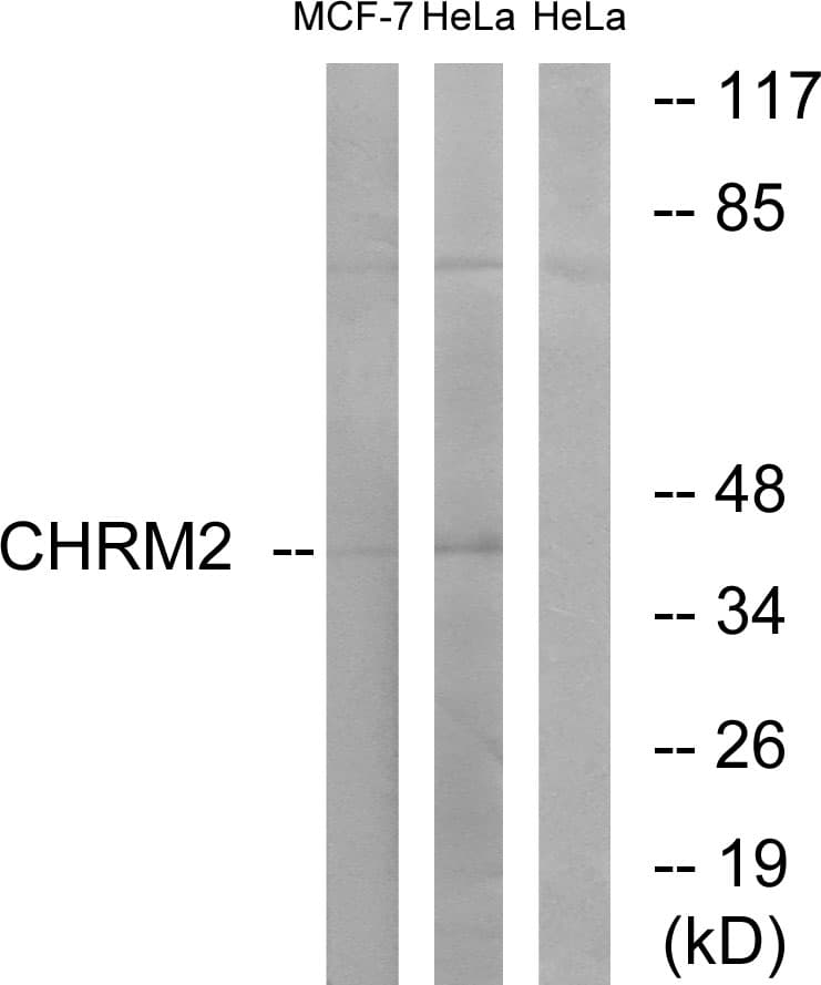CHRM2 / M2 Antibody (aa185-234)
