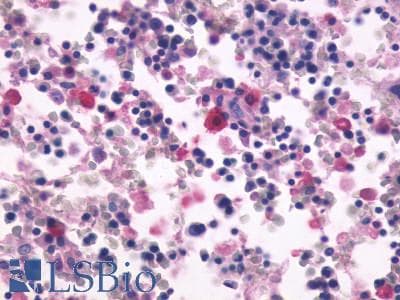PathPlus™ ADGRE5 / CD97 Antibody (N-Terminus)