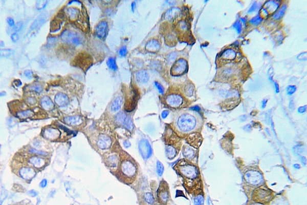 IGF1R / IGF1 Receptor Antibody (phospho-Tyr980)