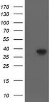 DNAJB1 / Hsp40 Antibody (clone OTI1E9)