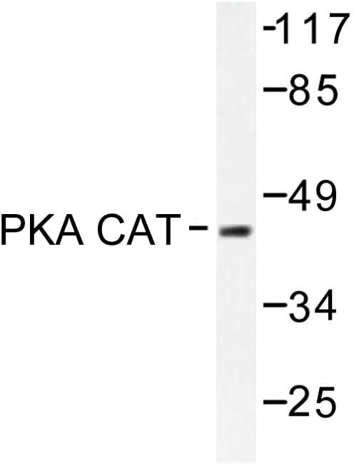 PRKACA + PRKACB Antibody (Val191)