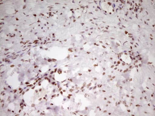 Monoclonal Mouse anti-Human SP110 Antibody (clone OTI4C1, aa232-521, IHC, WB)
