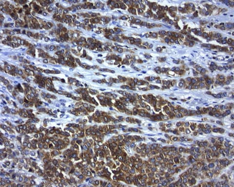 BCL2 / Bcl-2 Antibody (clone UMAB225)