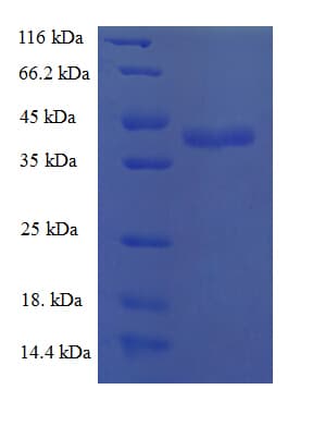 Human CCL25 / TECK Protein (Recombinant GST)