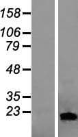 LCN1 / Lipocalin-1 Protein (Over-Expression Lysate Myc-DDK (Flag))