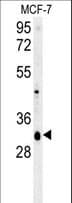 Polyclonal Rabbit anti-Human VTI1B Antibody (aa59-86, WB)