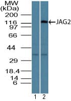 Polyclonal Rabbit anti-Human JAG2 / Jagged-2 Antibody (aa150-200, WB)