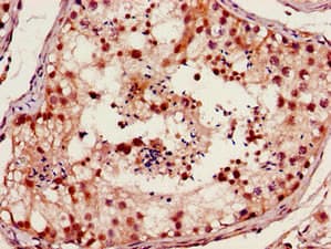 FOXM1 Antibody