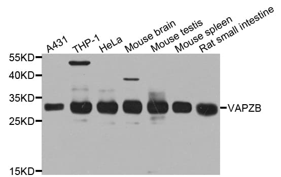 Polyclonal Rabbit anti-Human CAPZB / CAPZ Beta Antibody (AP, WB)