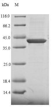 Human CHD1L Protein (Recombinant 6His-SUMO, N-terminus)