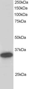 IHC-plus™ CBR / CBR1 Antibody (aa265-277)