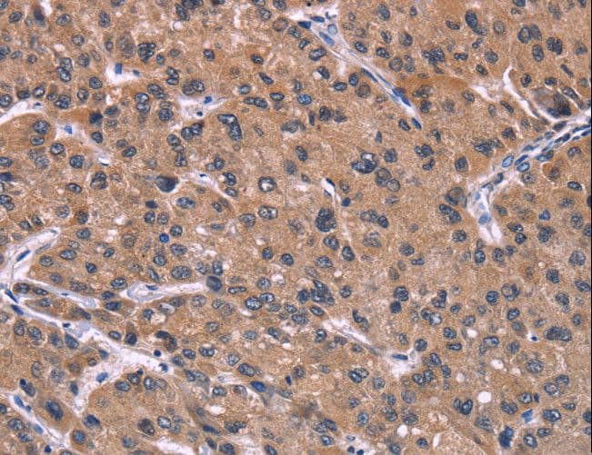 HSD2 / HSD11B2 Antibody