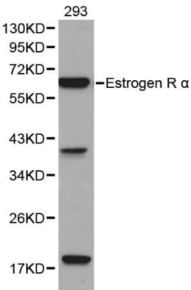ER Alpha / Estrogen Receptor Antibody