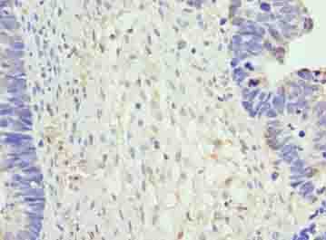 Polyclonal Rabbit anti-Human NR2C2AP / TRA16 Antibody (IHC, WB)
