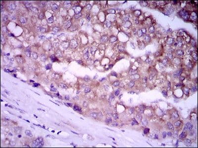 Monoclonal Mouse anti-Human GPC3 / Glypican 3 Antibody (clone 9C2, IHC, IF, WB)
