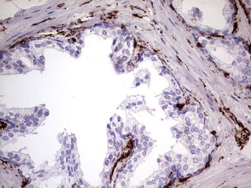 Vimentin Antibody (aa210-466, clone UMAB159)