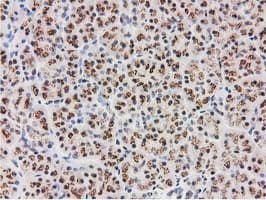 MGLL / Monoacylglycerol Lipase Antibody (clone OTI2B11)