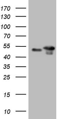 TP53 / p53 Antibody (clone OTI6C3)