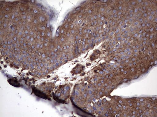 NUMB Antibody (aa1-365, clone OTI1B5)