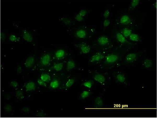 TRDMT1 / DNMT2 Antibody (clone 1E12)