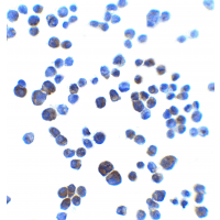 IHC-plus™ SHREW-1 / AJAP1 Antibody
