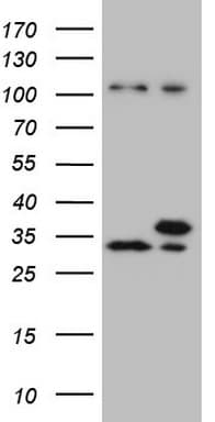 Monoclonal Mouse anti-Human WDR61 Antibody (clone OTI1D4, aa92-305, WB)