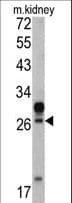 HOXA5 Antibody (aa196-223)