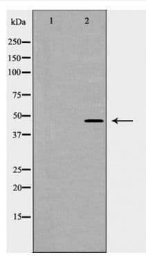 KRT17 / CK17 / Cytokeratin 17 Antibody