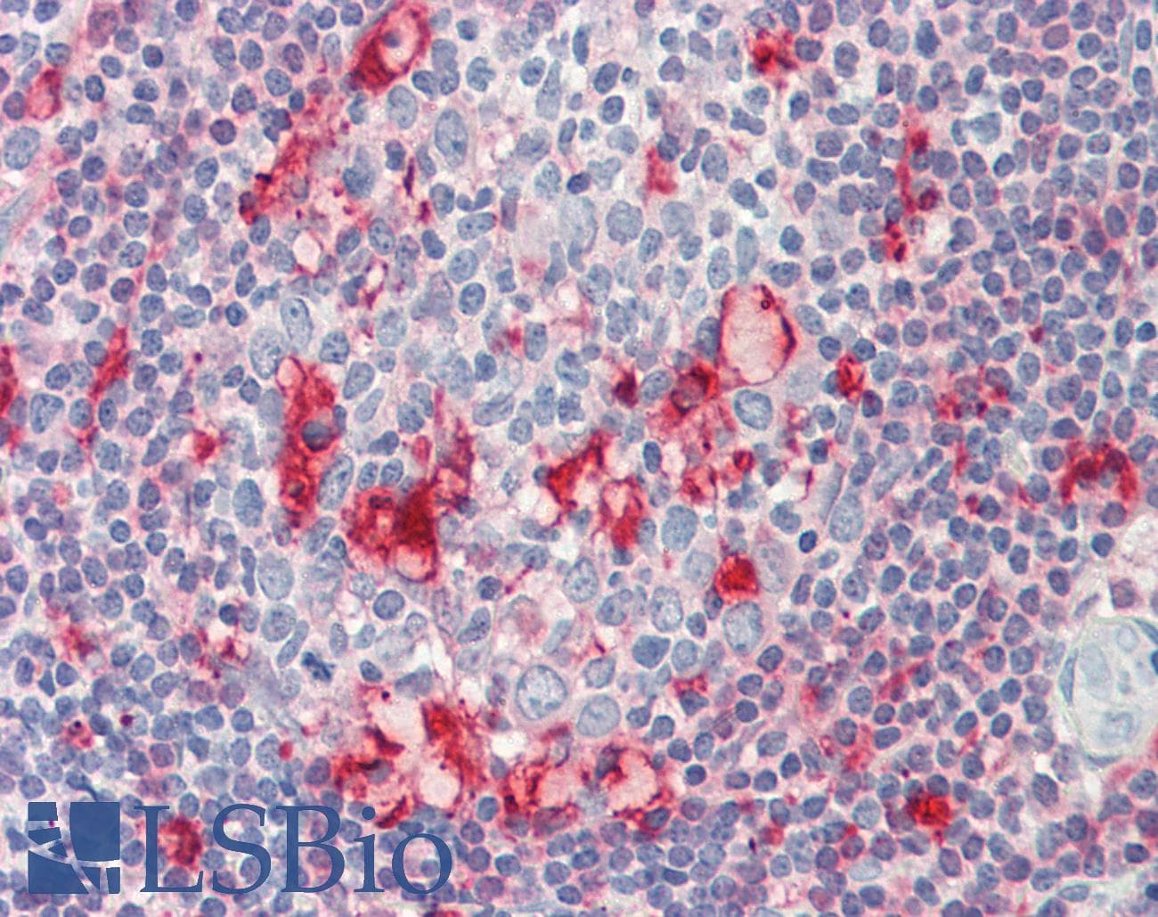 IHC-plus™ Polyclonal Goat anti-Human CAPG Antibody (aa147-159, IHC, WB)