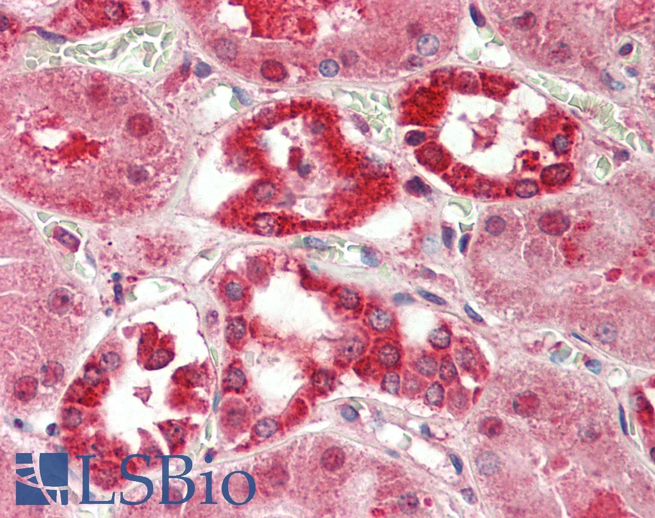 Polyclonal Rabbit anti-Human LPPR5 Antibody (aa36-85, IHC, WB)