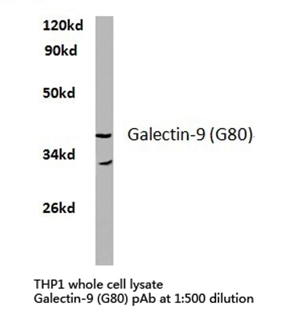 LGALS9 / Galectin 9 Antibody (Gly80)